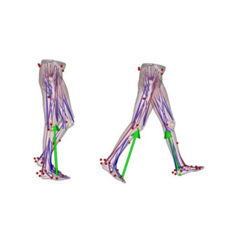 Avatar Orthopaedics Surgical Planning Models