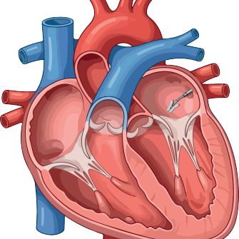 Secure Biomedical precision heart valve repair