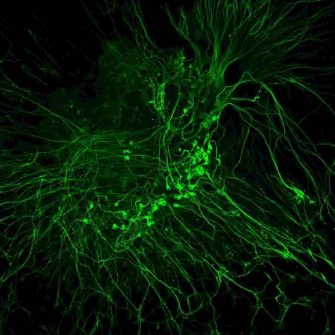 organotypic-explant-of-mouse-auditory-neurons