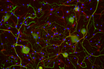 DRG neurons