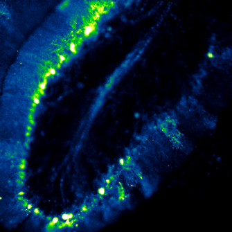 Imaging Ca2+ loading in a mouse cerebellar brain slice using a genetically encoded calcium reporter (GCaMP5g) delivered via an AAV viral vector.