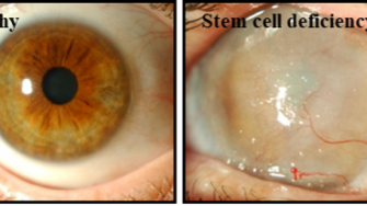 Di Girolamo Group: Ocular Diseases Research