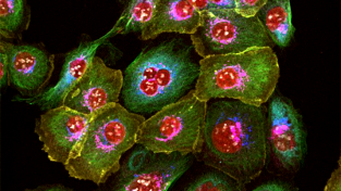 Lock Group: Cancer Systems Microscopy Lab