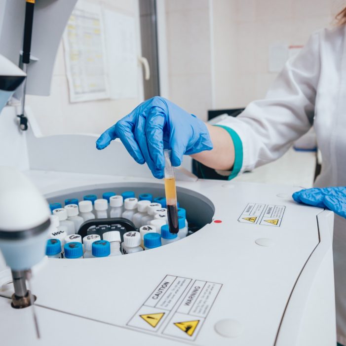 Medical equipment. Biochemistry test. Technology