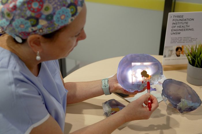 a doctor holding the 3d print of a patient brain
