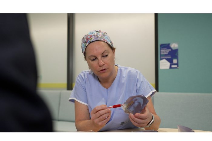 a doctor holding the 3d print of a patient brain