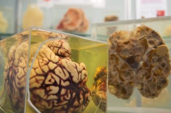 Specimens from the Museum of Human Disease