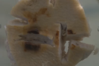 cancer-metastasis