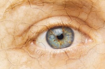 Cracked Skin. Closeup of a female eye with cracked skin. Aging process or pain and loneliness conceptual image.