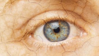 Cracked Skin. Closeup of a female eye with cracked skin. Aging process or pain and loneliness conceptual image.