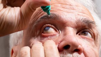 Self-instillation of eye drops in patients with glaucoma eyes. An elderly man with glaucoma.