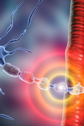 Doctor examining MRI images of patient with multiple sclerosis at table in clinic, closeup