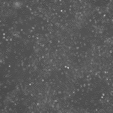 endothelium