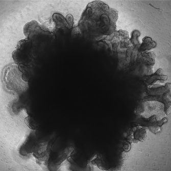 branching-lung-organoid.jpeg