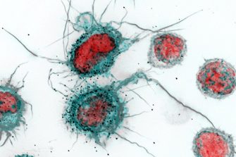 HIV micrograph