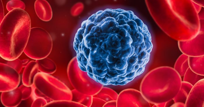 Zúženie ciev: Melanómové bunky prežívajú a šíria sa vďaka stiesneným priestorom