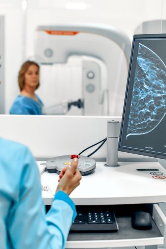 A woman undergoing a mammogram examination.