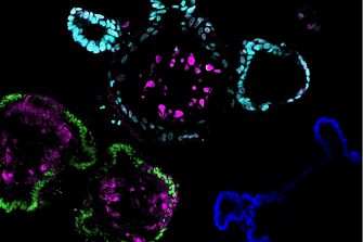 An artistic rendering of airway organoids and DNA, adapting our organoids into a Fibonacci-inspired spiral to reflect the idea of personalised biology and treatment