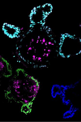 An artistic rendering of airway organoids and DNA, adapting our organoids into a Fibonacci-inspired spiral to reflect the idea of personalised biology and treatment