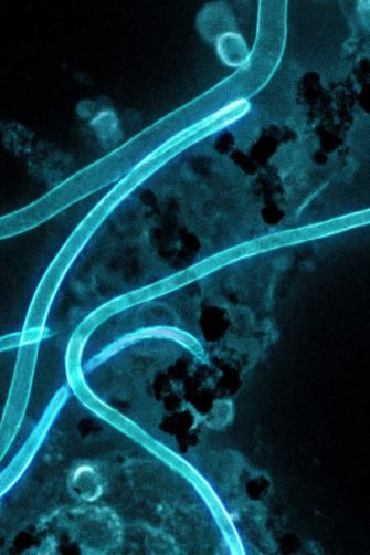 Ebola virus particles under an electron microscope