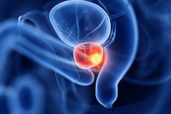 3d rendered medically accurate illustration of prostate cancer