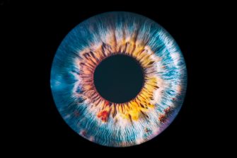 Signs of macular degeneration (via little lumps) in an image of the retina.