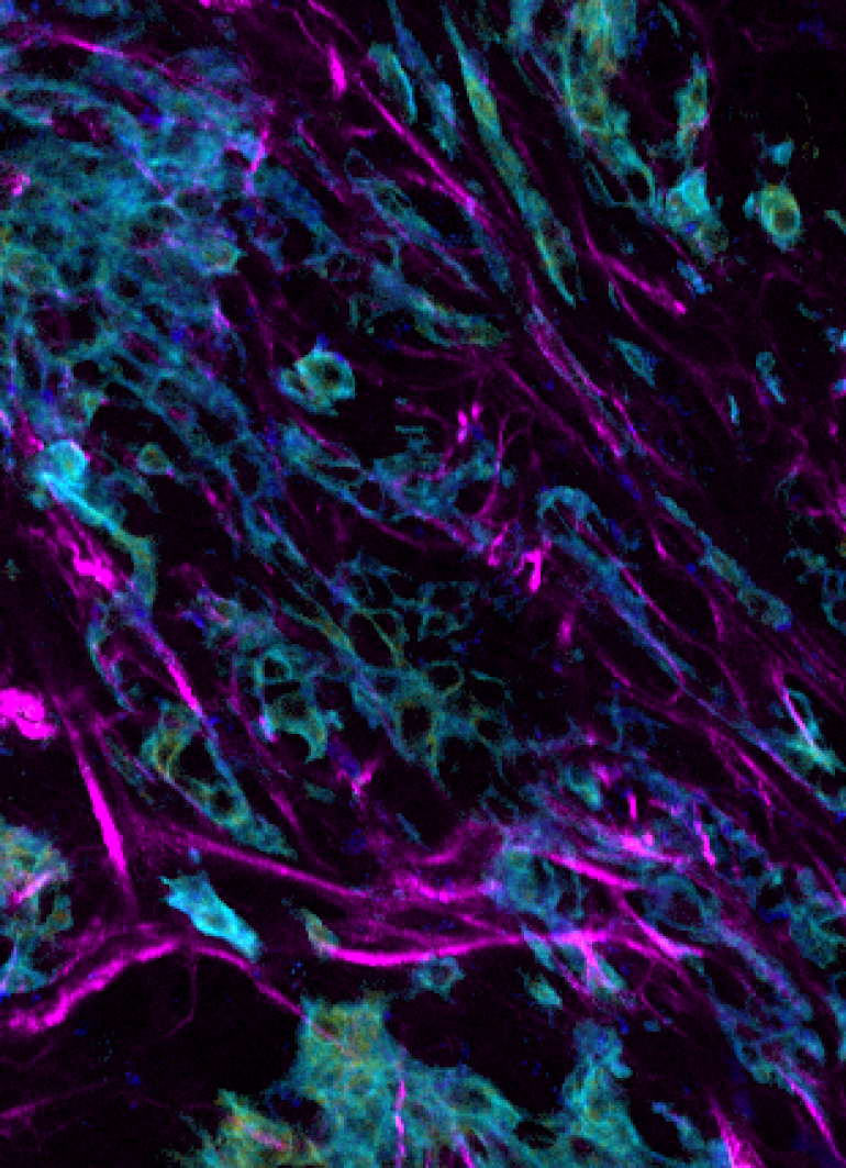 Anti-Cancer Drugs in Action