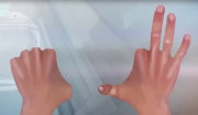 hands, post amputation. All fingers from the left hand and the pointer finger of the right hand are missing.