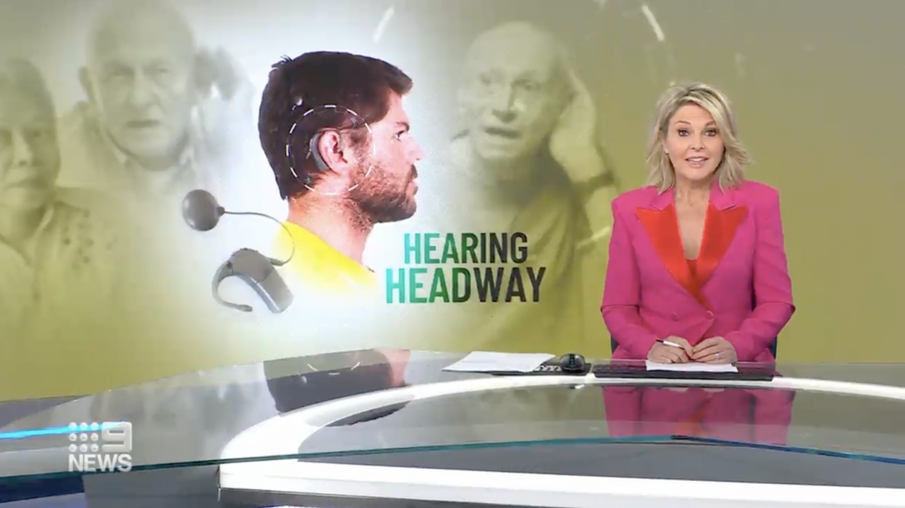 Cochlear implant 9 News