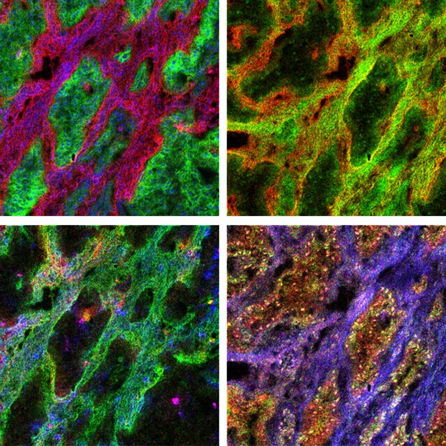 Imaging mass cytometry (IMC)