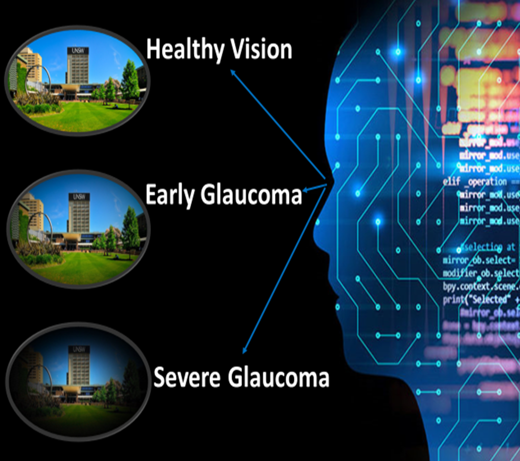 Image showing effects of glaucoma