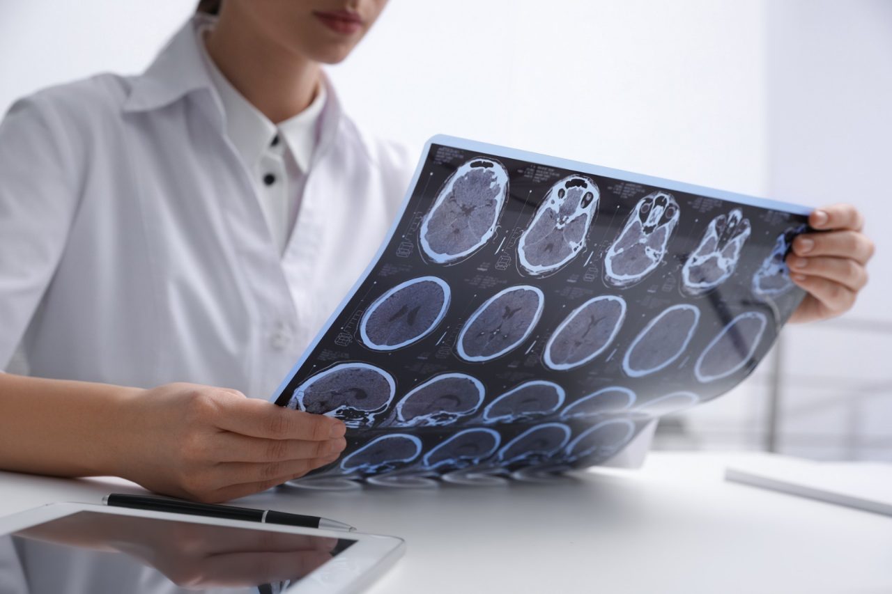 Doctor examining MRI images of patient with multiple sclerosis at table in clinic, closeup