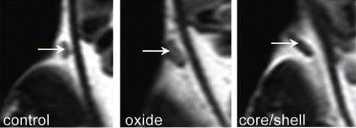 Figure 1: MRI images from iron-iron oxide core-shell nanoparticles injected into a mouse to enhance the contrast of a tumour.2